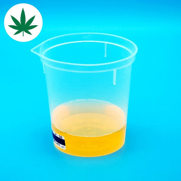 Cannabis, THC, Marijuana test in urine.