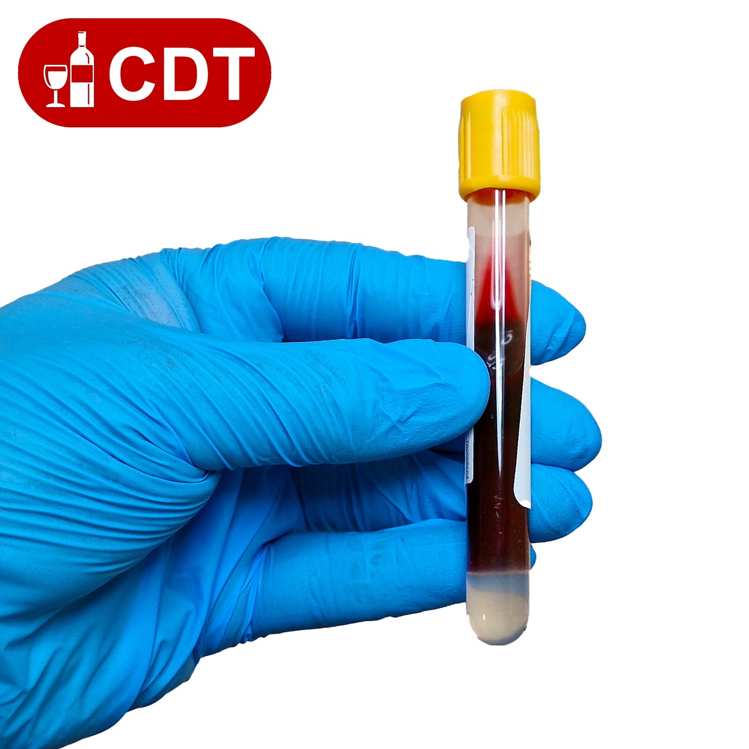 CDT Blood Testing